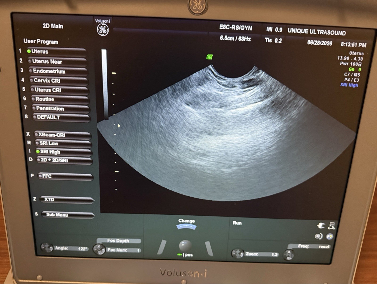 GE VOLUSON i BT14 2015 OB/GYN ULTRASOUND, BOX ONLY, PROBES ARE NOT INCLUDED.