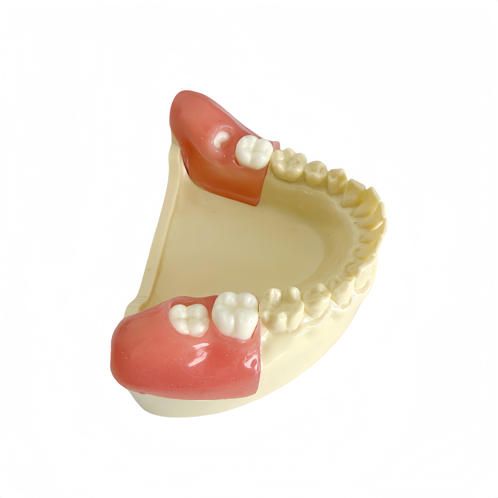 Dental Training Model for Impacted Wisdom Tooth Extraction Practice Surgery