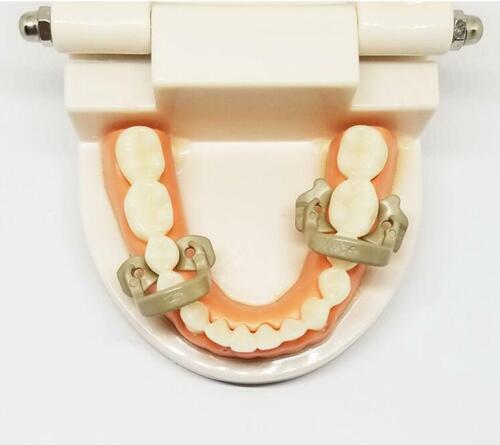 Dental Barrier Clips Rubber Dam Clamps Clip Soft Resin Molar/Premolar Fit Kerr