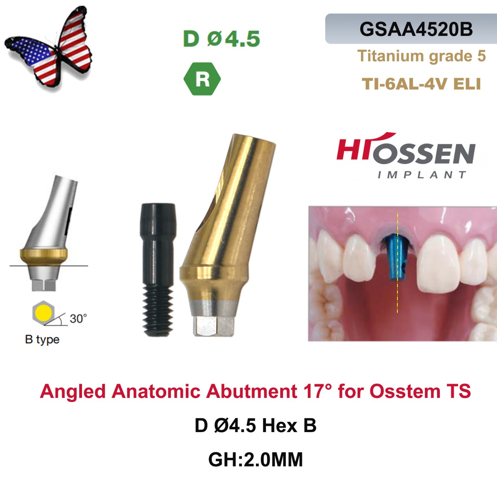 US 17° Angulated Abutment Regular Hex A/B Type For Osstem TS Regular Platform Ti