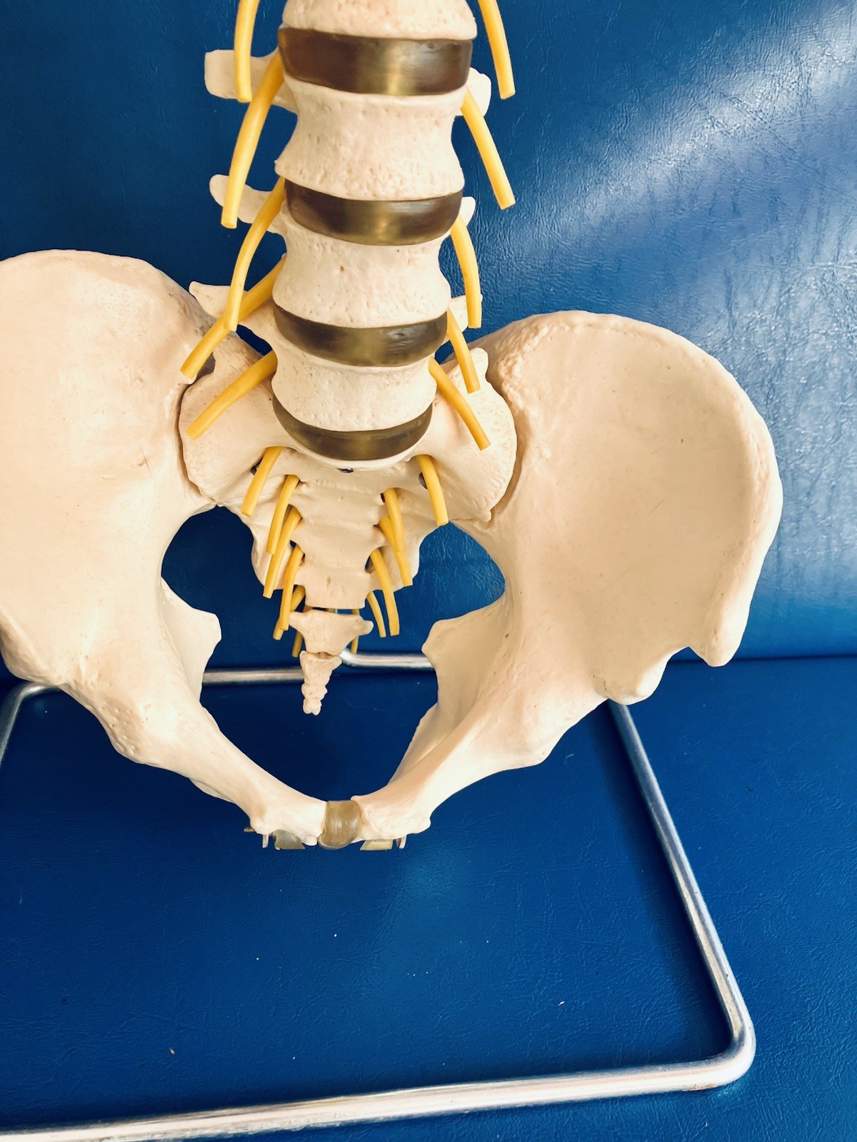 Vintage SOMSO Flexible Human Spine Model with Pelvis – Made in West Germany