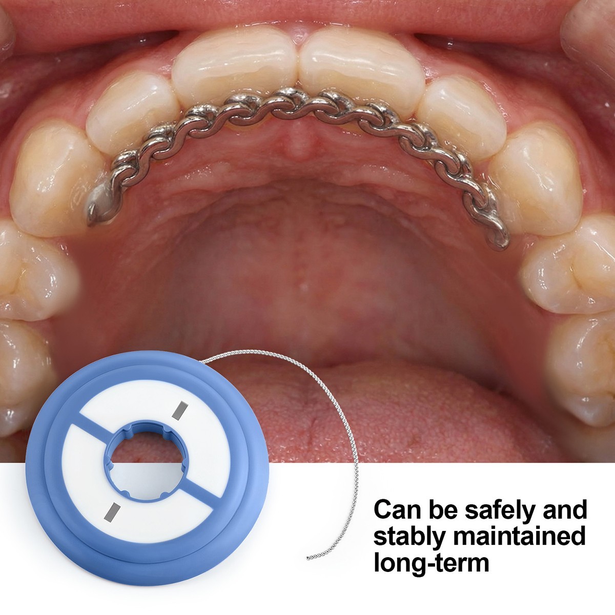 Cadena de Retenedor de Acero Inoxidable Ortodoncia Dental Alambre de 40 Pulgadas