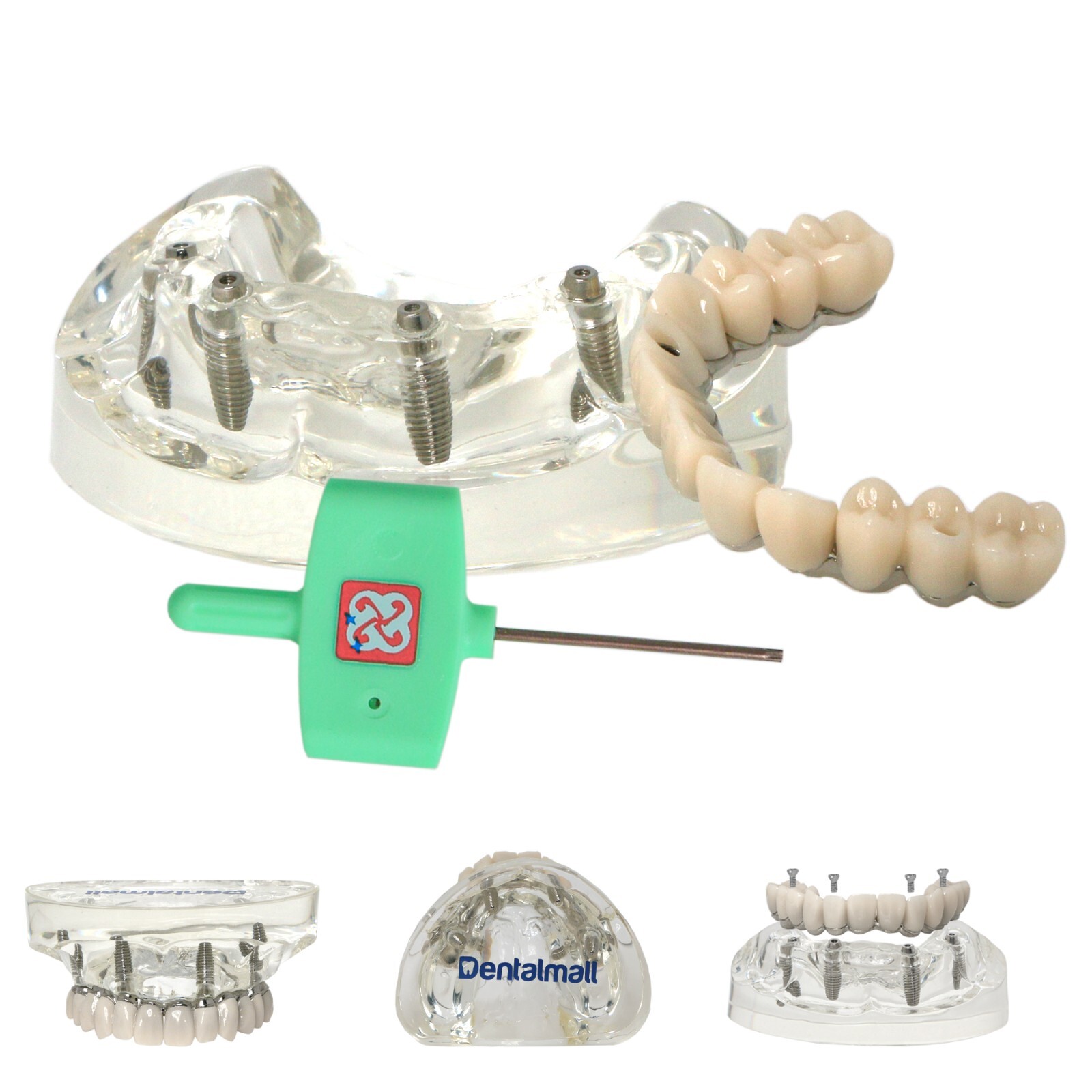 Dental Implant Model Upper Lower Jaw Demo All on 4/6 Overdenture treatment model