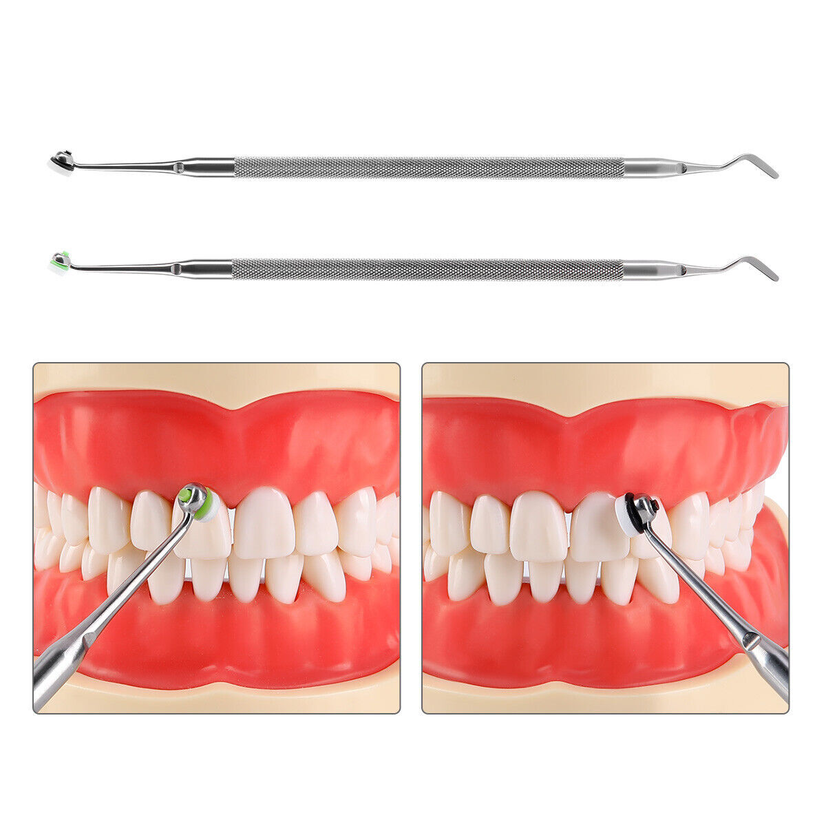 Dental Resin Filling Kit Molding Tool Material Quick Composite Foam Pads Handle