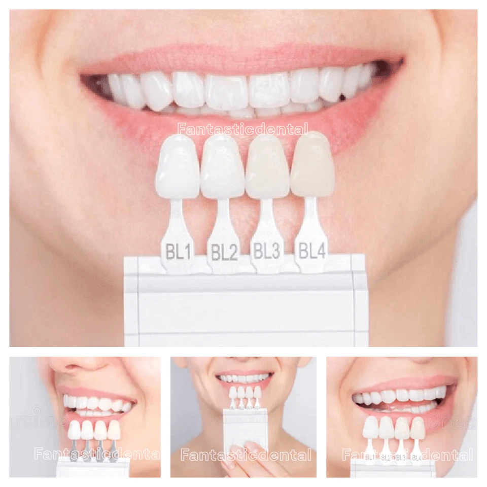 Dental Bleach Shade Guide BL1 4Colors Bleached Chart Teeth Based Vita US STOCK