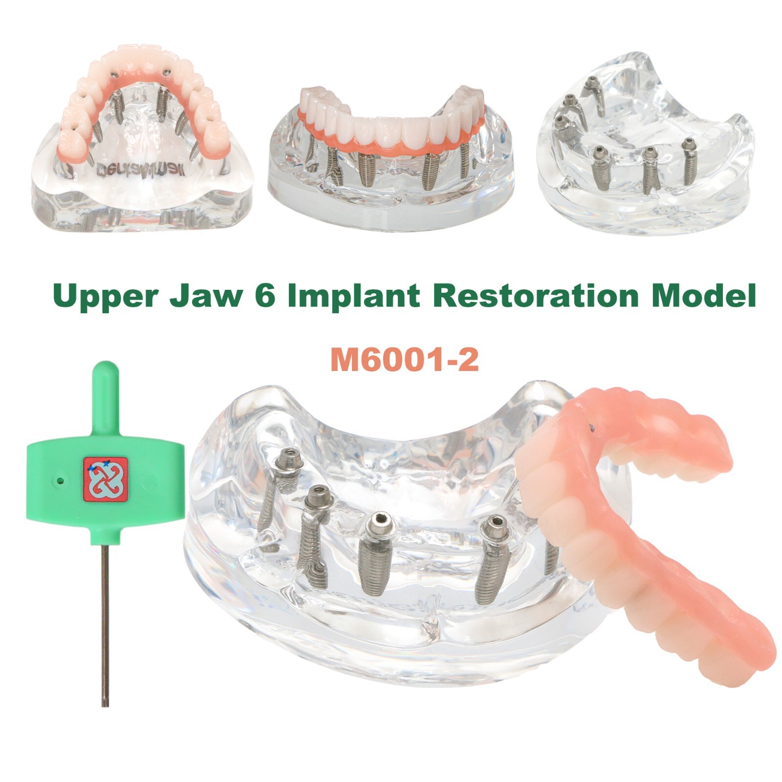 All-on-4/6 Screws Restoration Overdenture Dental Implant Model Upper/Lower Jaw