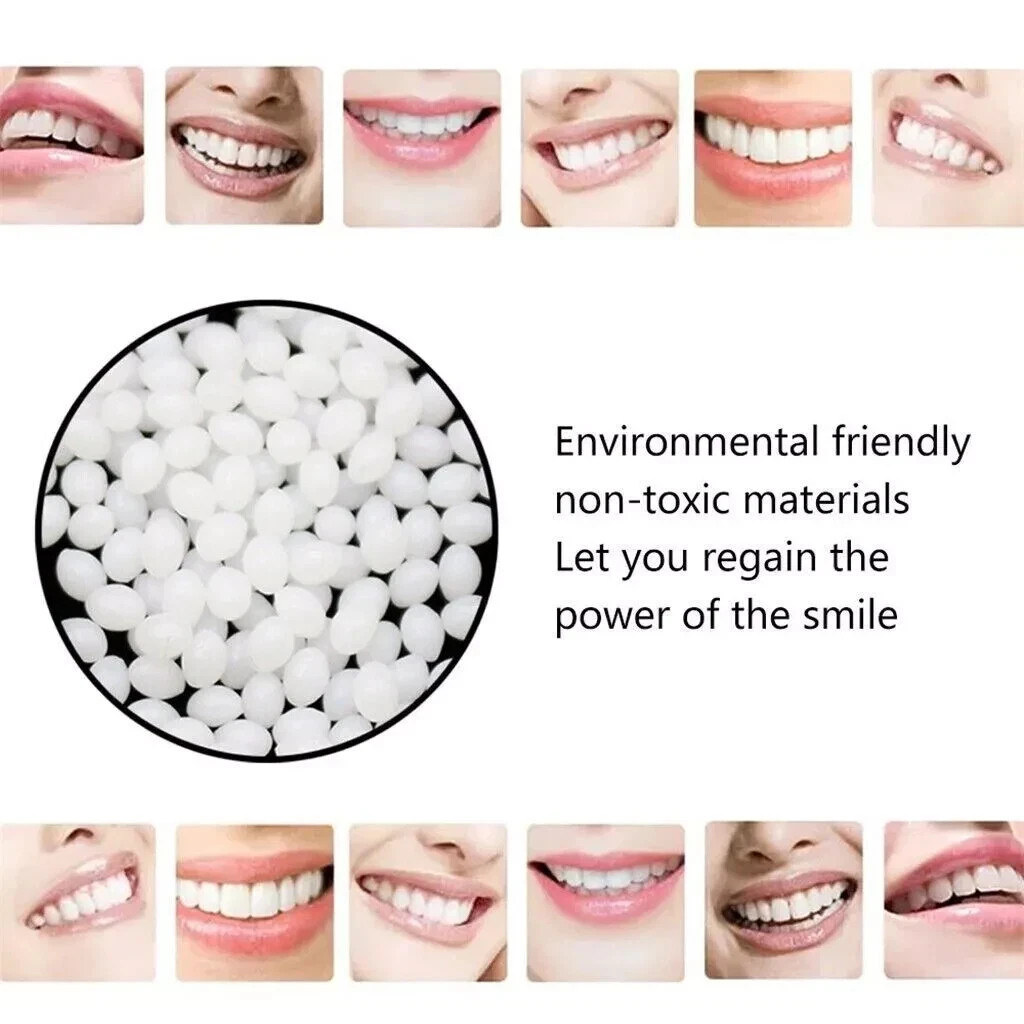 Dental Thermal Beads Replacement Temporary 25g ﻿Tooth Denture False Repair Tool