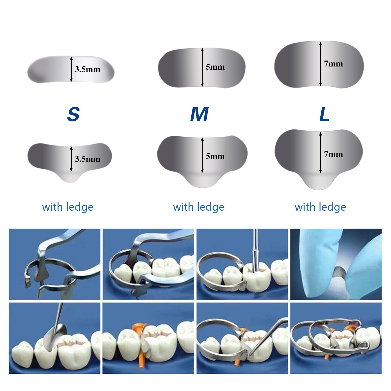 50 Pcs Dental Metal Matrices Matrix Band Sectional Contoured Refill S/M/L 35μm