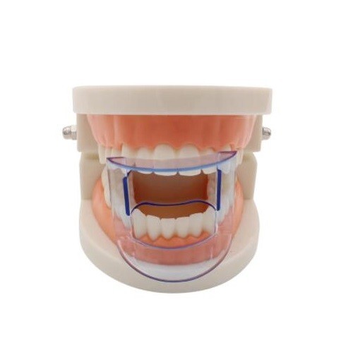 Dental Mouth Opener Lip Retractor Cheek Expander Bite Props Anterior Posterior