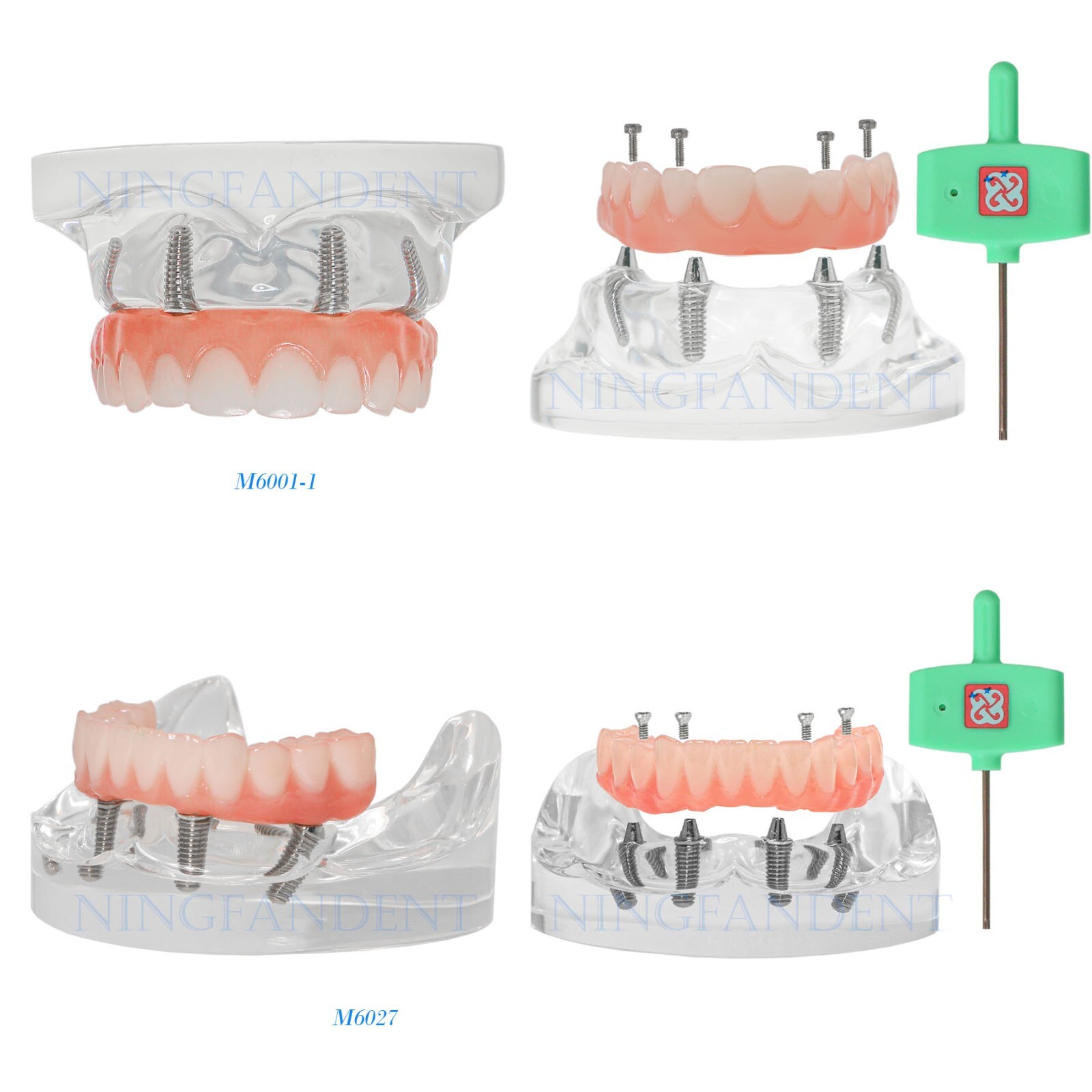 Dental All-on-4 Overdenture Implant Model, Upper/Lower Jaw-Clear,With 4 Screw