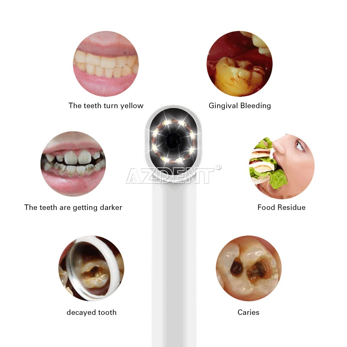 AZDENT Dental USB Intraoral Camera Oral Endoscope Real-time Video 8 LED light