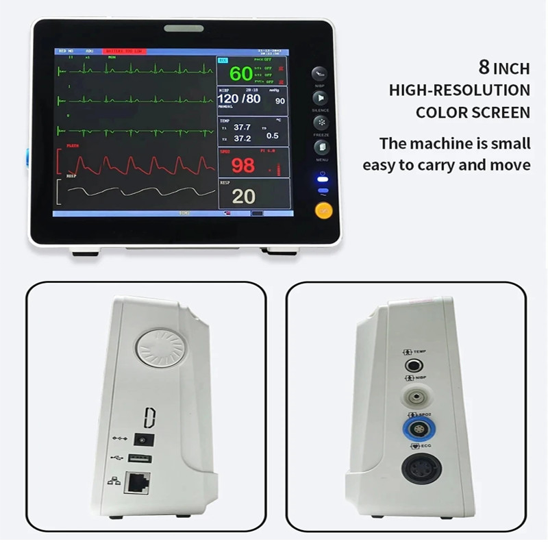 8″ Multiparameter Patient Monitor -ECG, NIBP, SpO2, PR, Temperature, Respiration