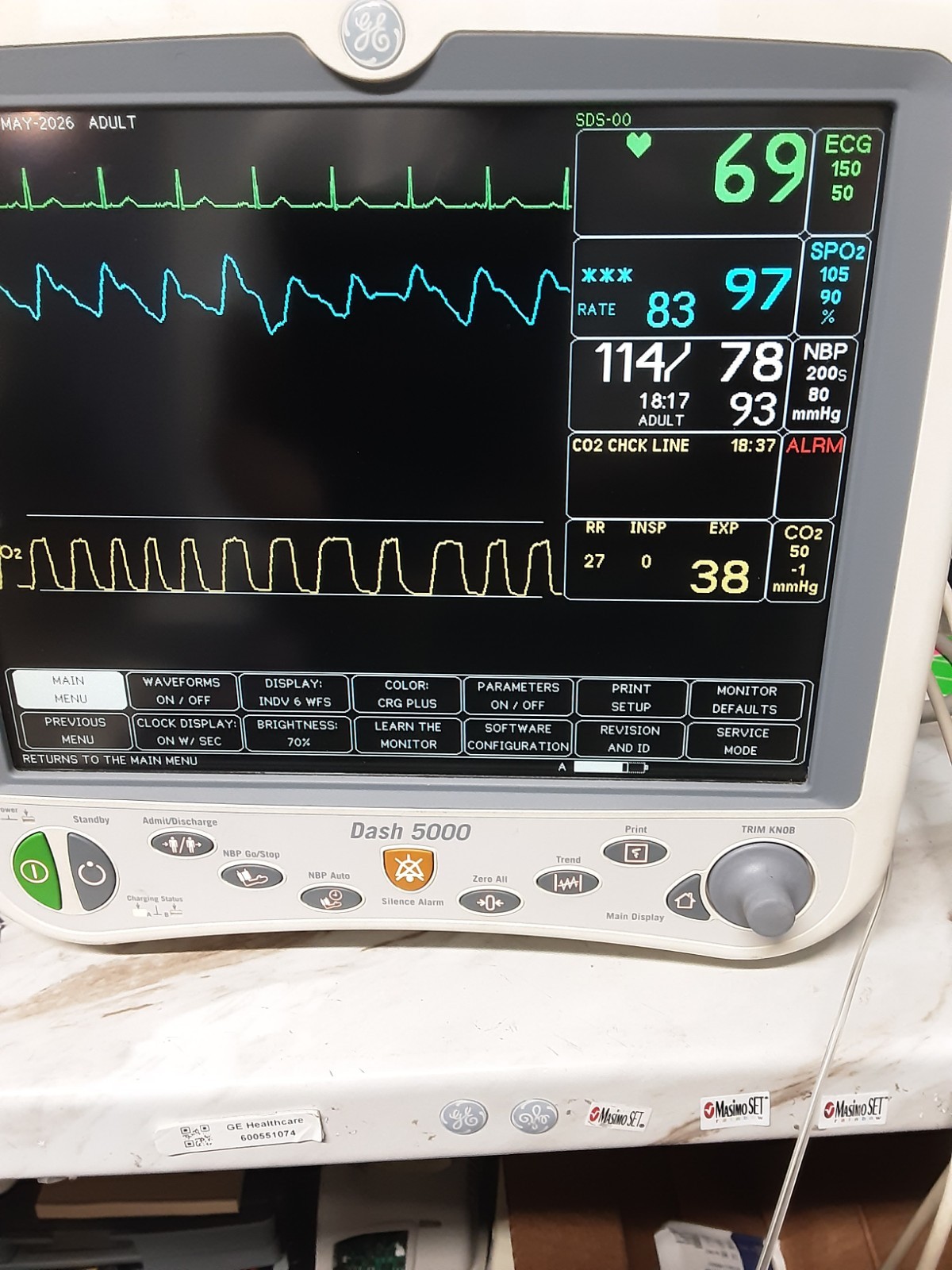 GE Dash 5000 massimo sp02 and soft 7.3 with 4 IBP and Co2 , 90 DAYS FREE RETURN