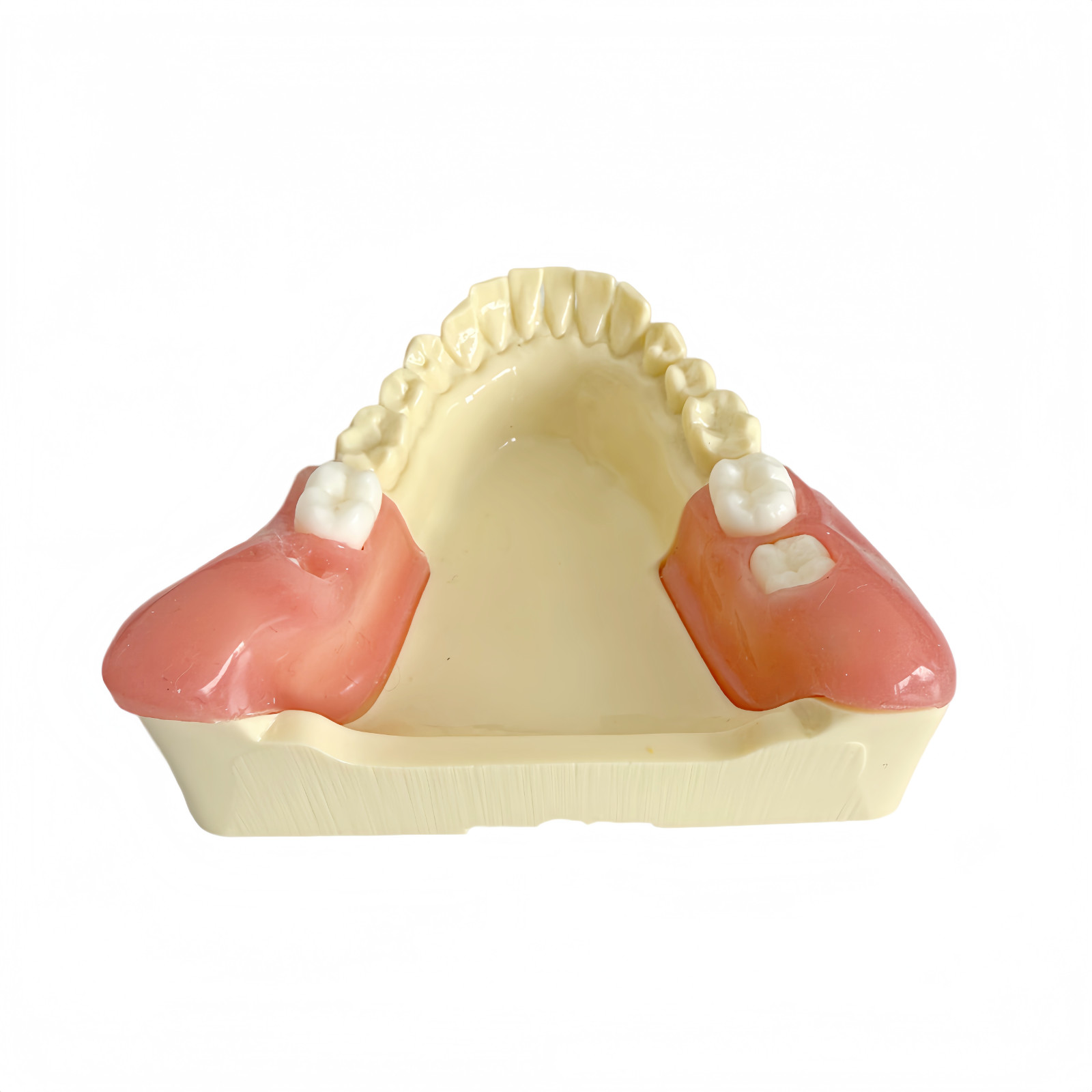 Dental Training Model for Impacted Wisdom Tooth Extraction Practice Surgery