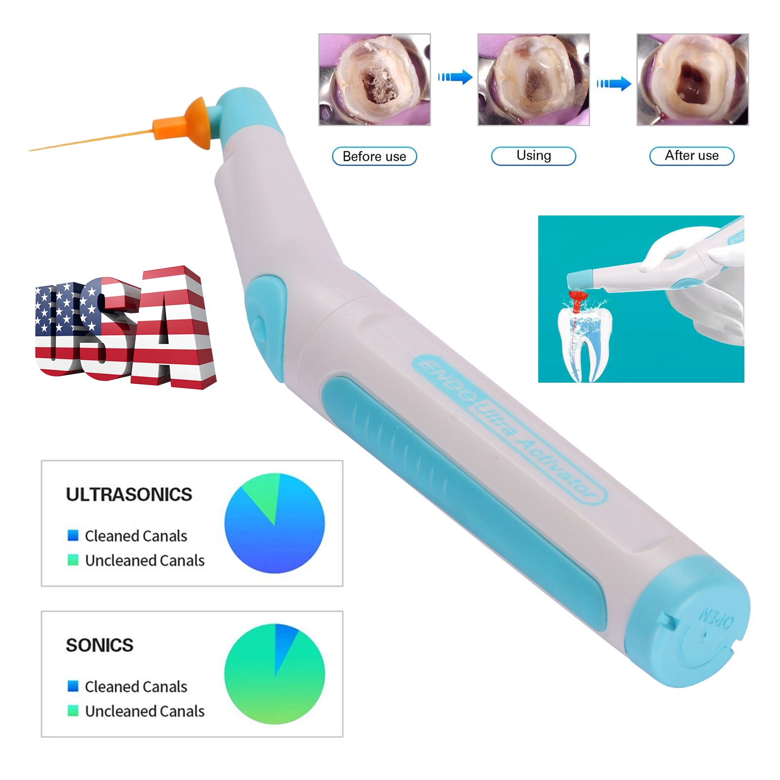 Dental Universal Implant Prosthetic Kit Torque Wrench Screw Drivers Remover pro