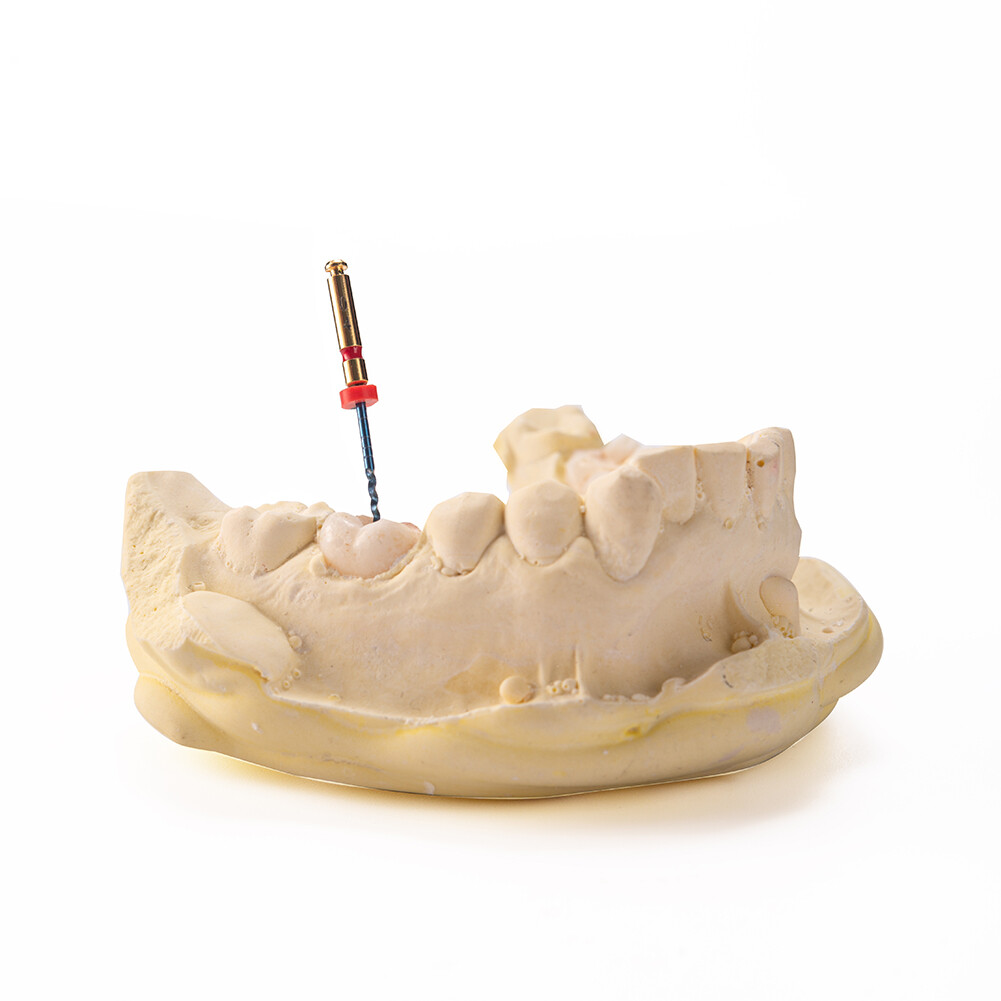 Easyinsmile Dental X-Pro Gold Taper Endodontic Rotary Files Endo Root Canal File