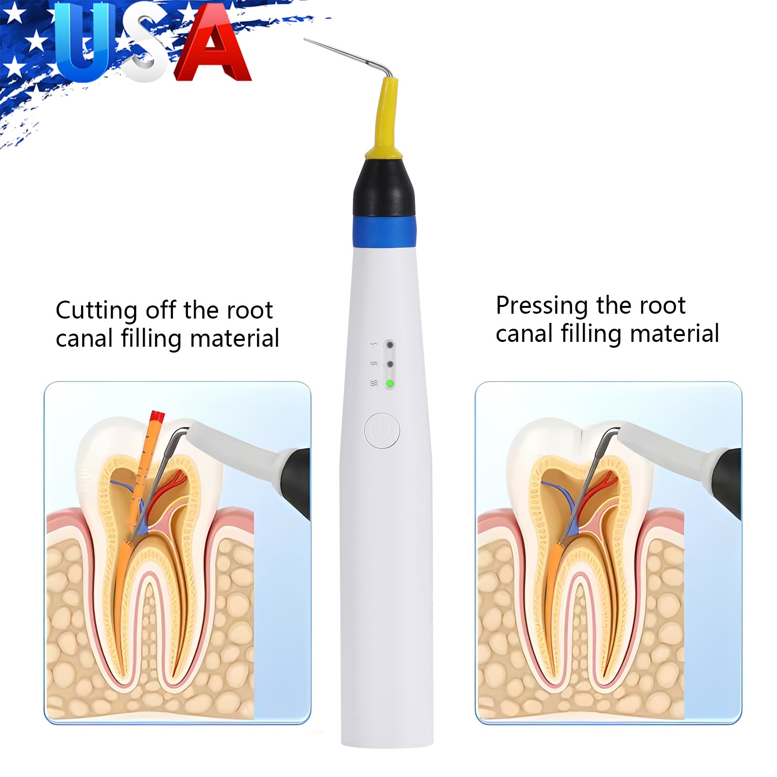 Dental Piezo Bone Cutter Piezosurgery Ultrasurgery Bone Cutter Machine Motor