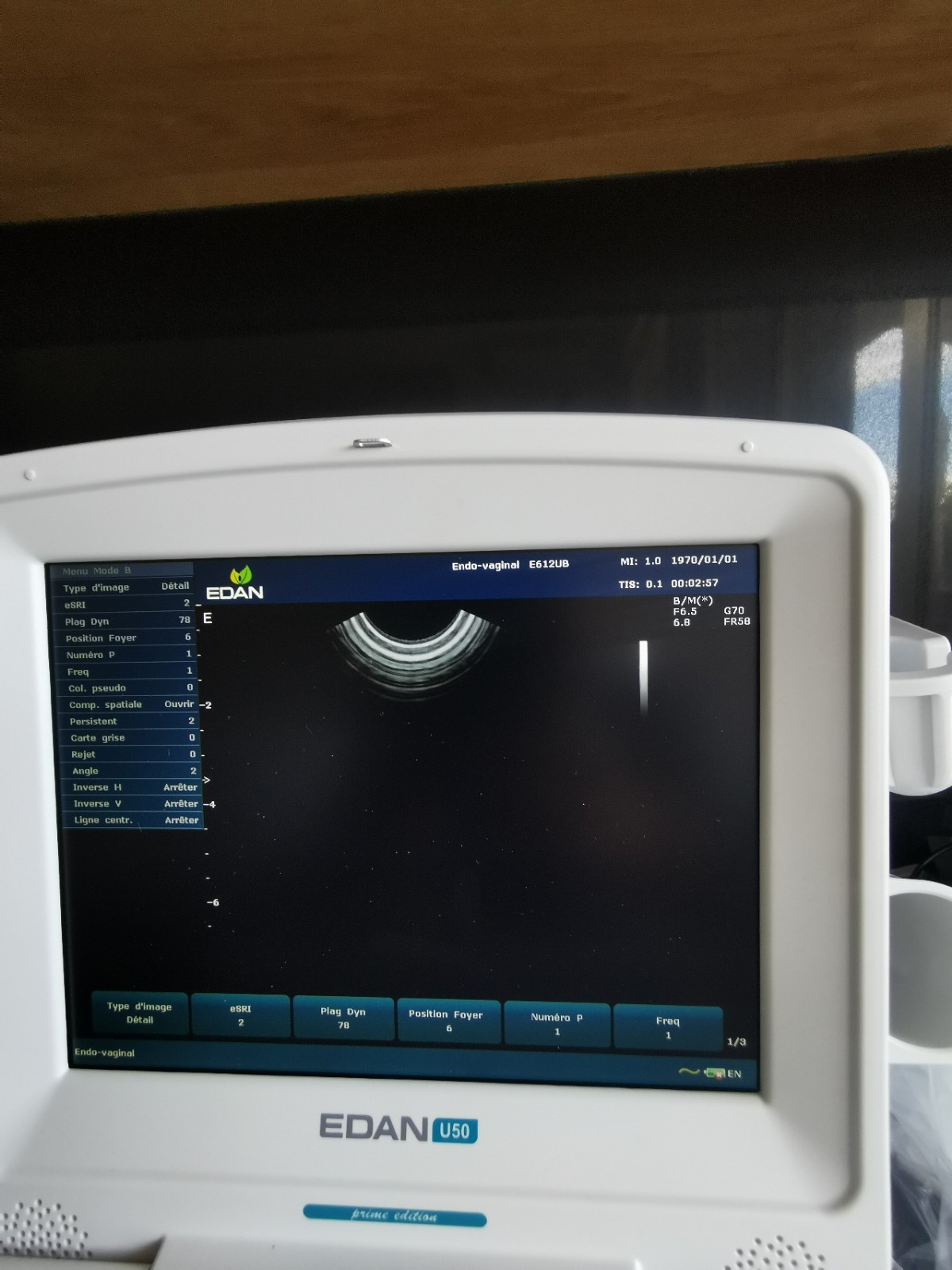 EDAN U50 DEMO Ultrasound System with 2 probes