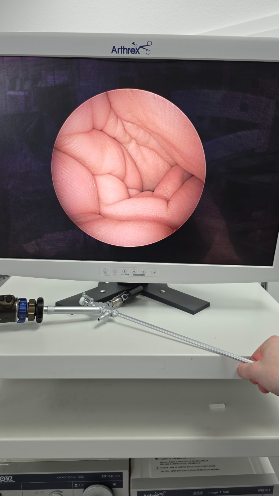 Karl Storz 27293AA Hopkins Optics Endoscope Endoscope 6° Nephroscope Nephroscope