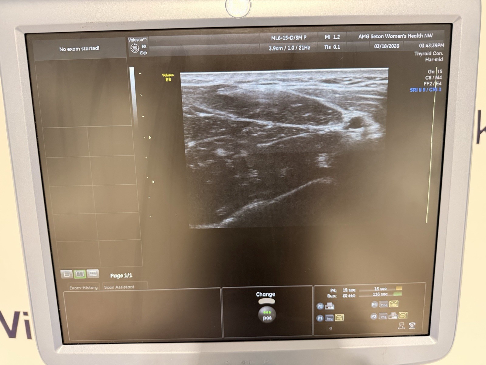 GE Voluson E8 Expert Ultrasound | 2 Probes | 4D HDlive | All Options | Warranty