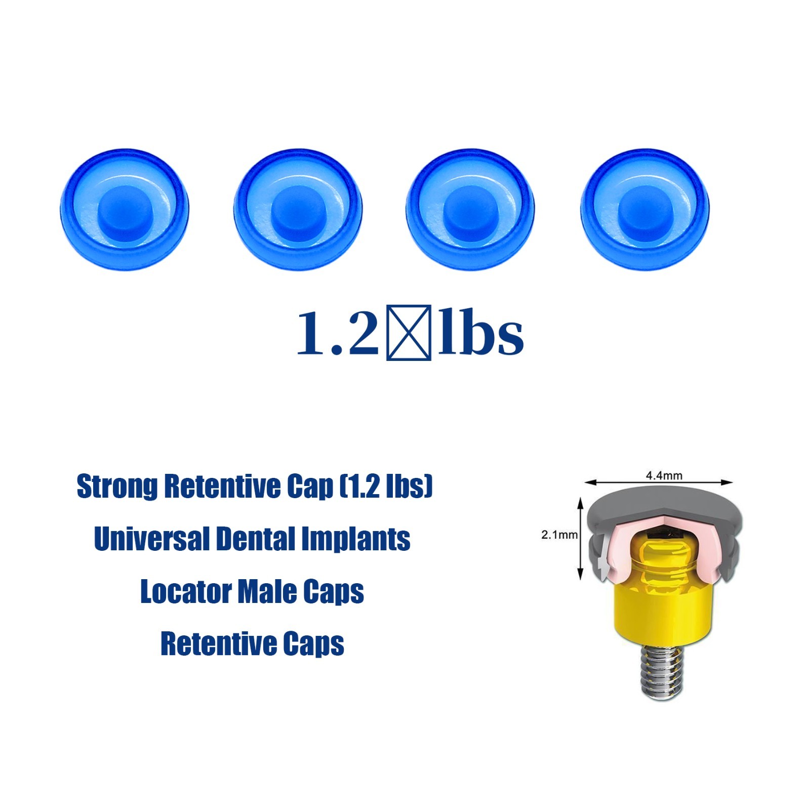 Locator Abutment for Hiossen ET DIO UF/Snucone Regular Overdenture Retention Cap