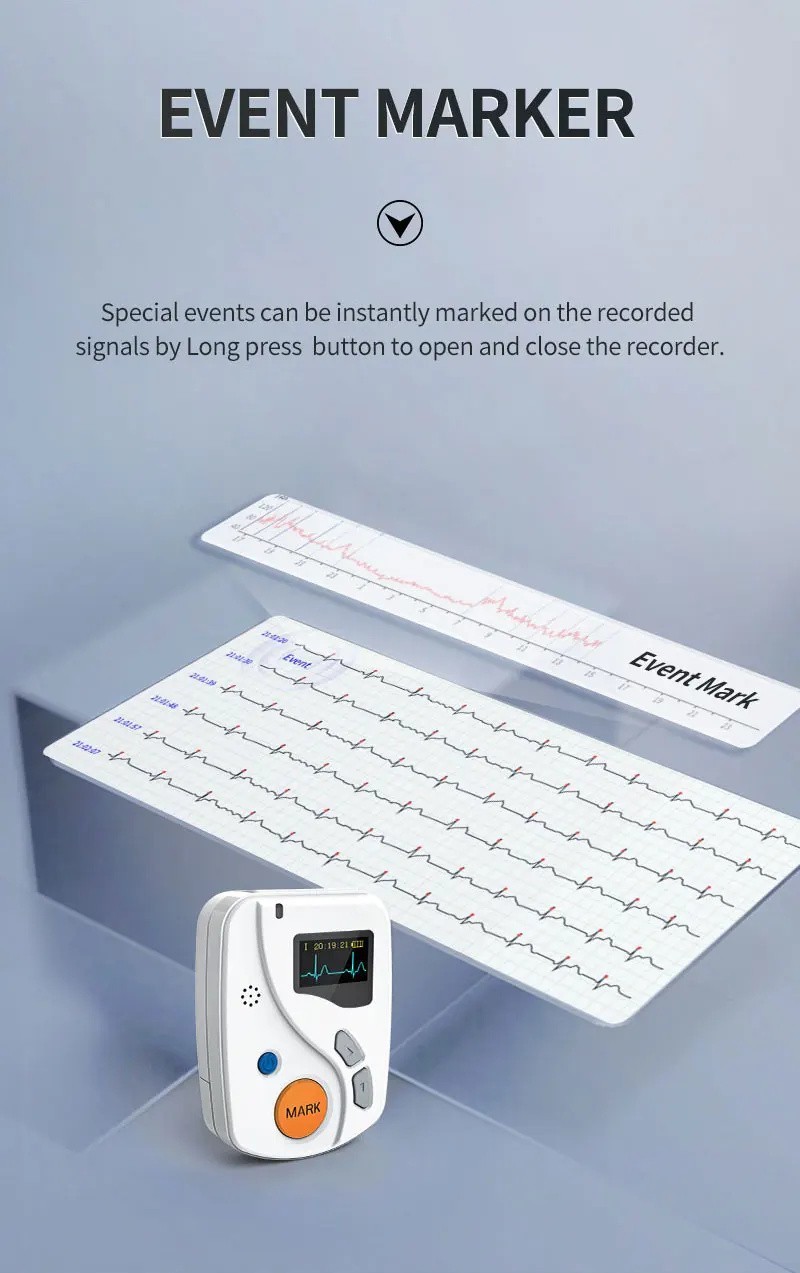 24 Hours Dynamic ECG Systems 12 Channel EKG Monitor ECG holter Recorder Software