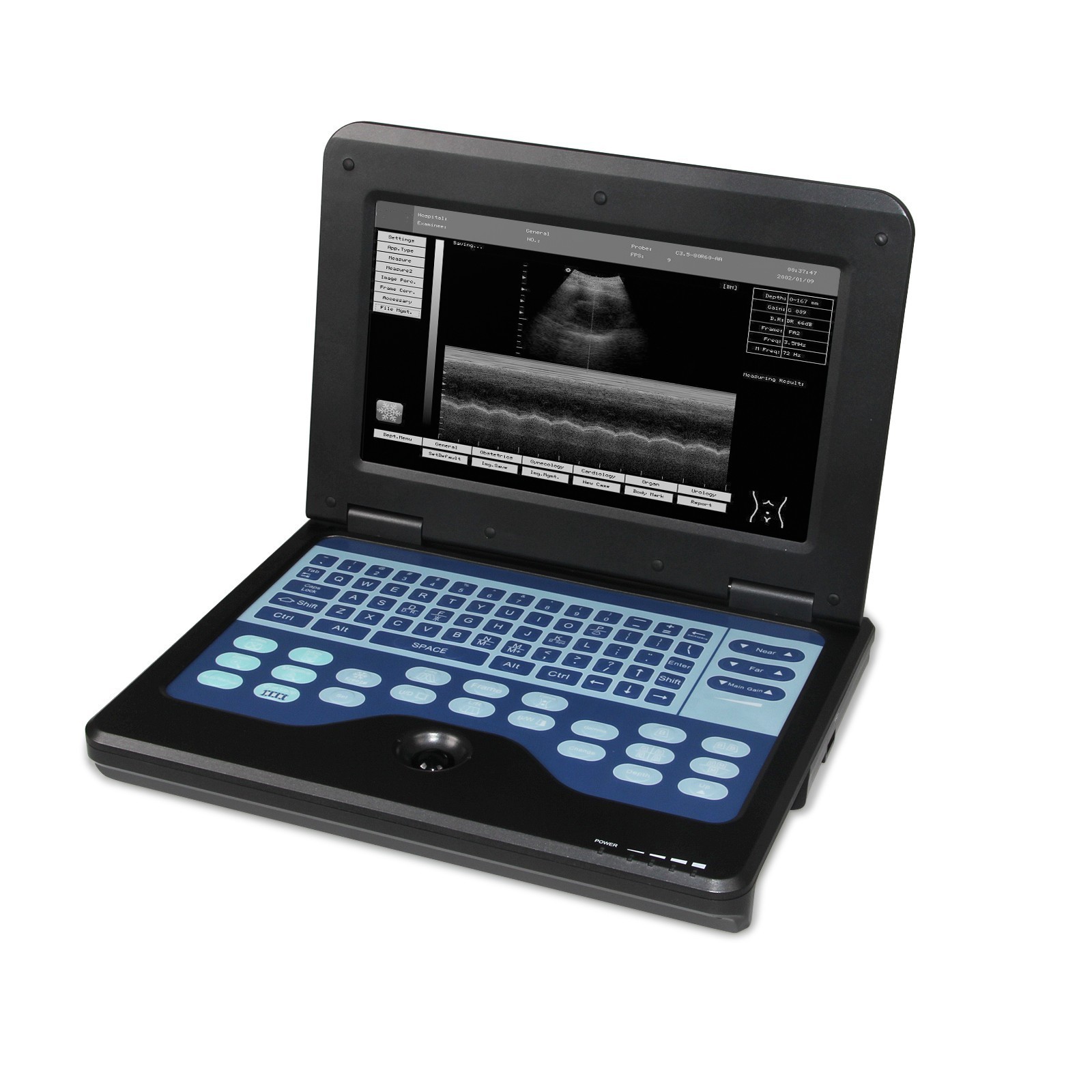 New Portable Ultrasound Scanner Machine Diagnostic System escáner de ultrasonido