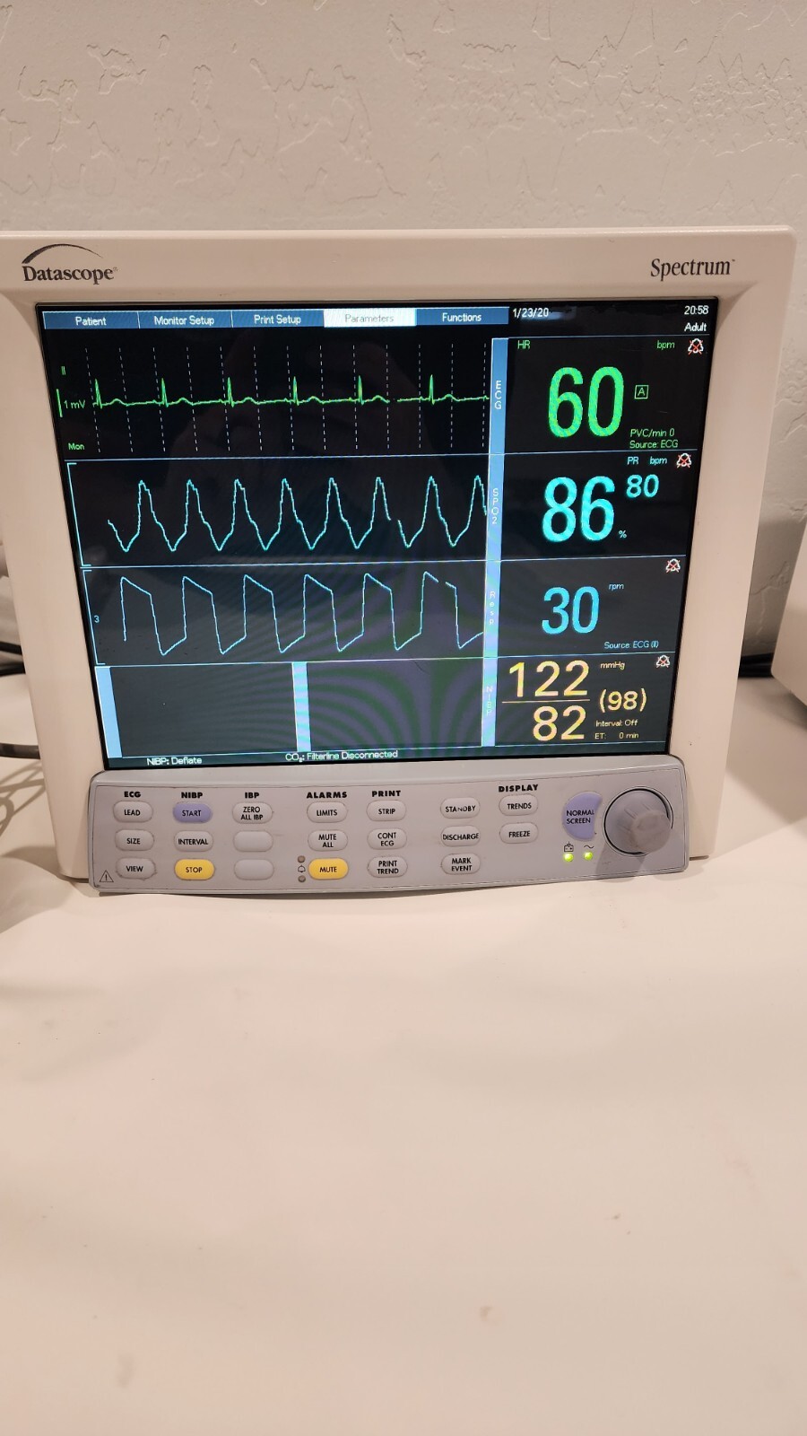 Mindray Datascope Passport Spectrum Monitor with Micro Stream EtCO2