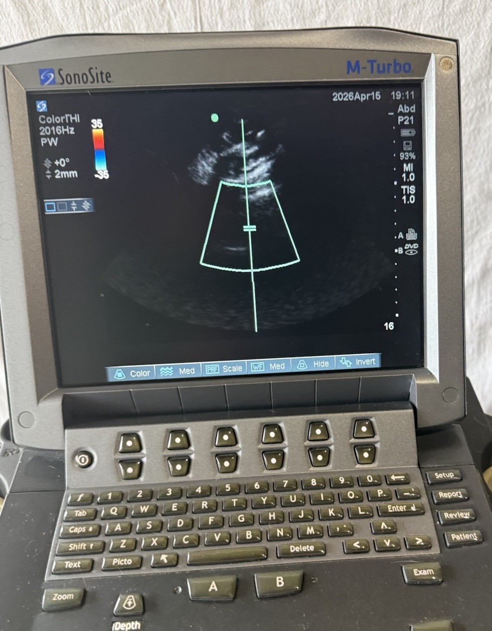 SonoSite M-Turbo Ultrasound With Cart & P21x Transducer Probe