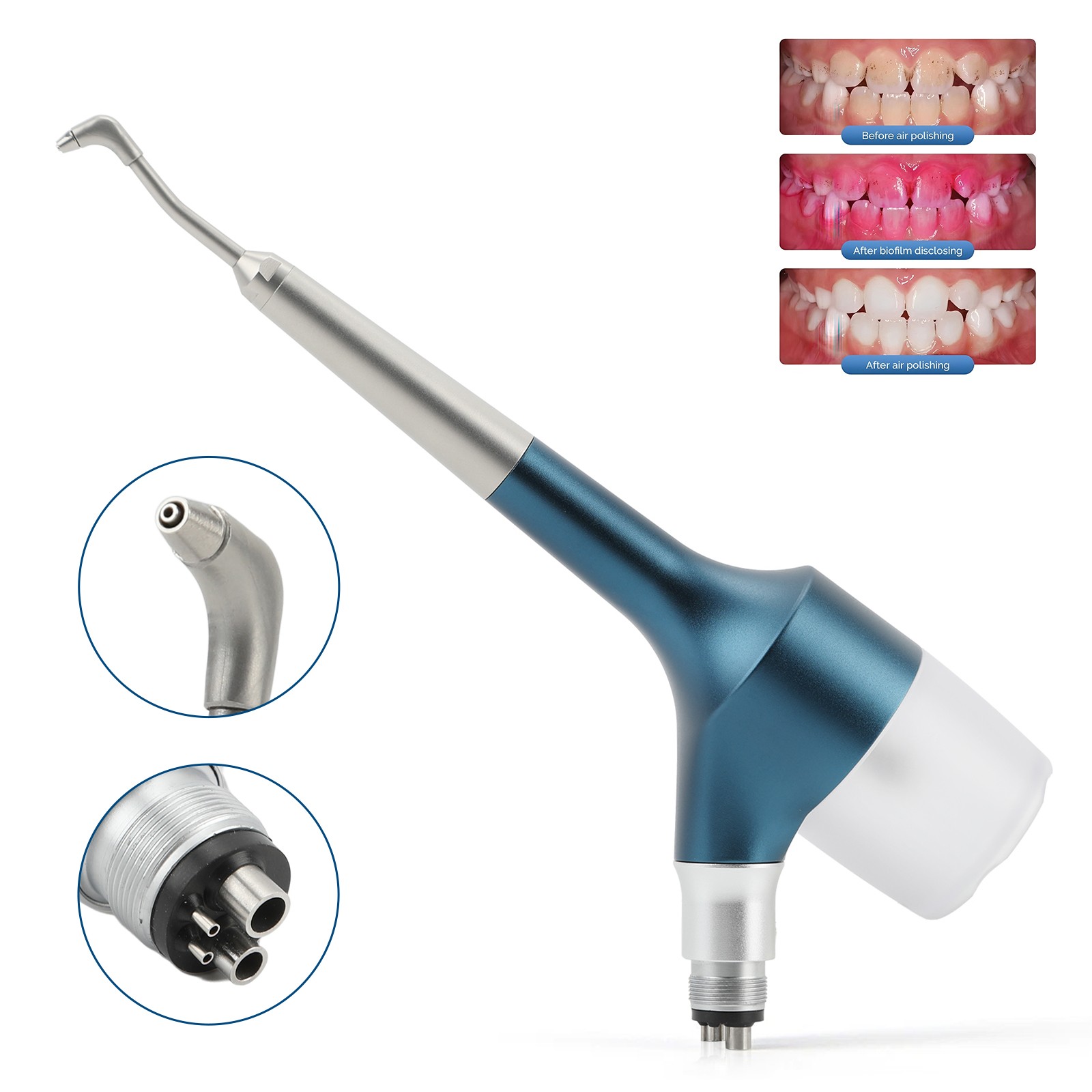 N/E-type Dental Air Flow Teeth Polishing Hygiene Prophy Jet 4 Holes