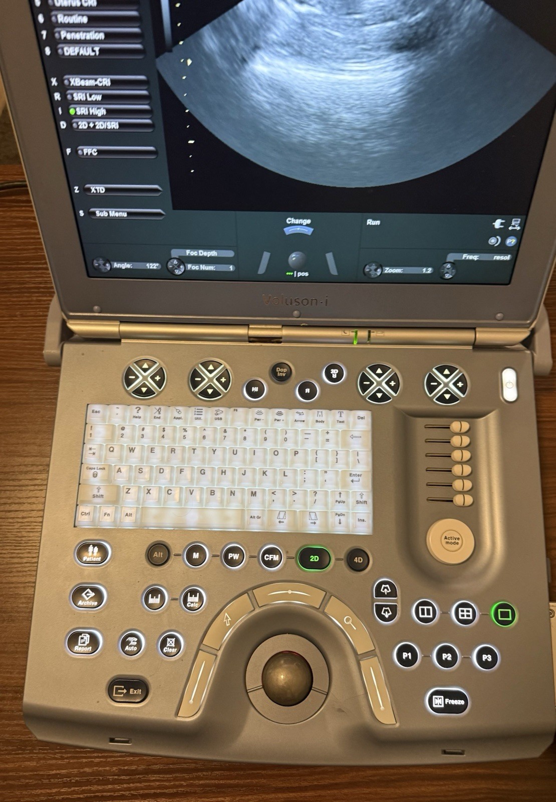 GE VOLUSON i BT14 2015 OB/GYN ULTRASOUND, BOX ONLY, PROBES ARE NOT INCLUDED.