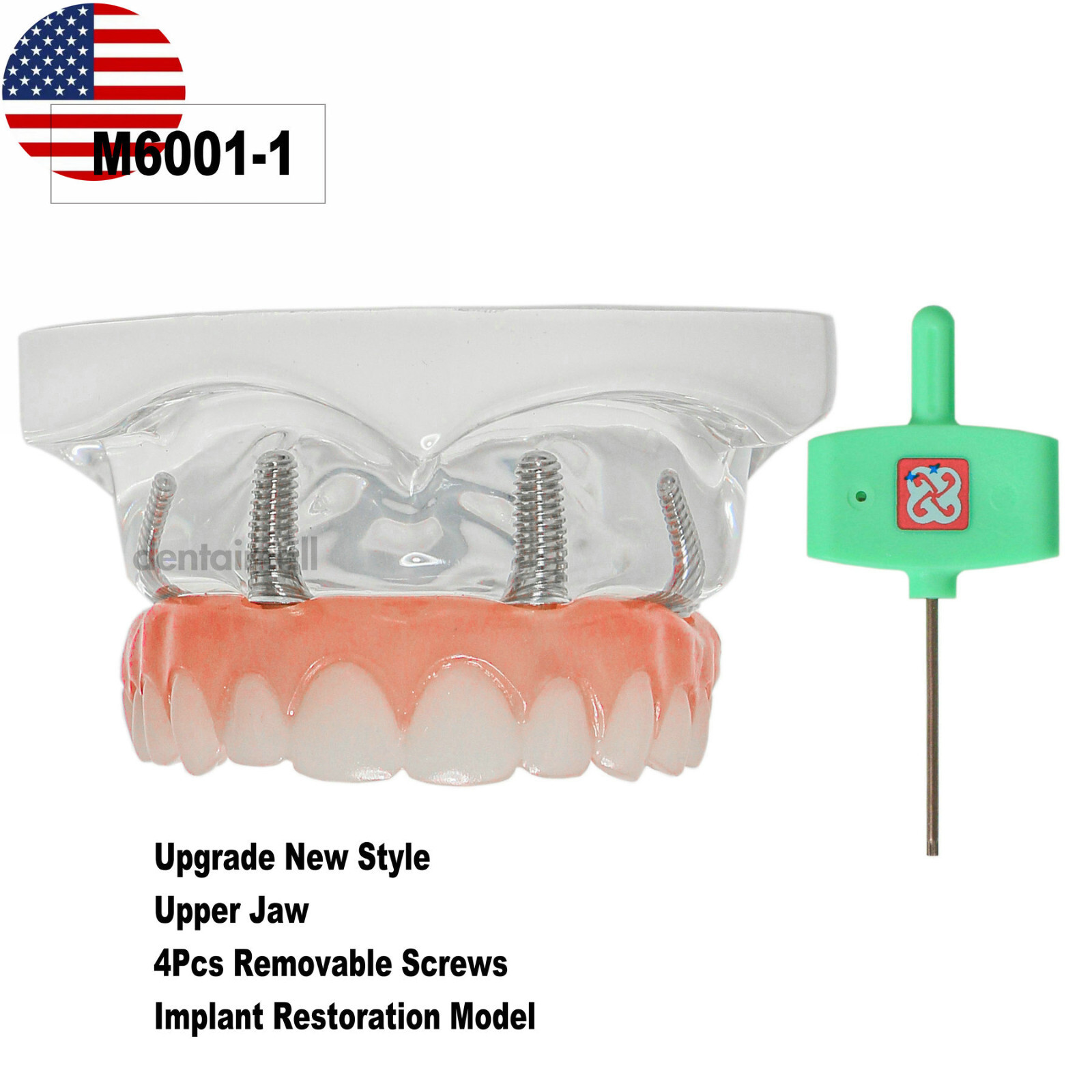 US Dental Overdenture Implant Model All-on-4 With 4 Screw Upper/Lower Clear Jaw