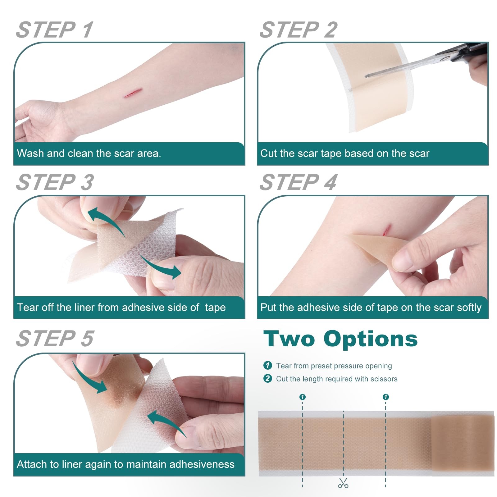 Silicone Scar Sheets (1.6″x 158″ Roll-4M), Medical Grade 1.6″×158″, no