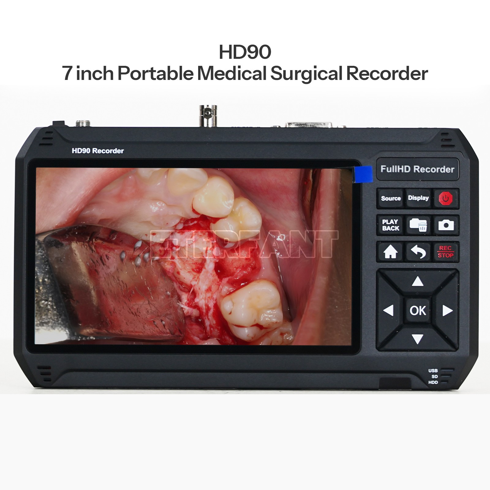 1080p 60Hz HD90 Portable Medical Surgical Recorder for Laparoscopy and Endoscopy