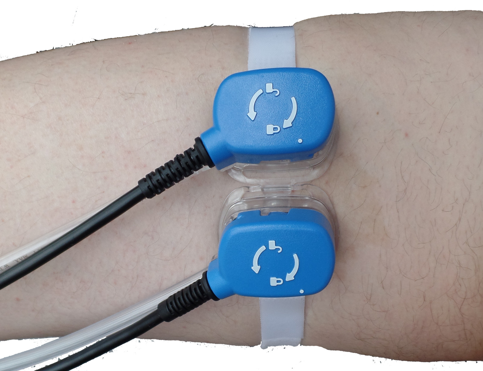 EPITECH 1002 Epidermal Harvesting System – FDA Registered