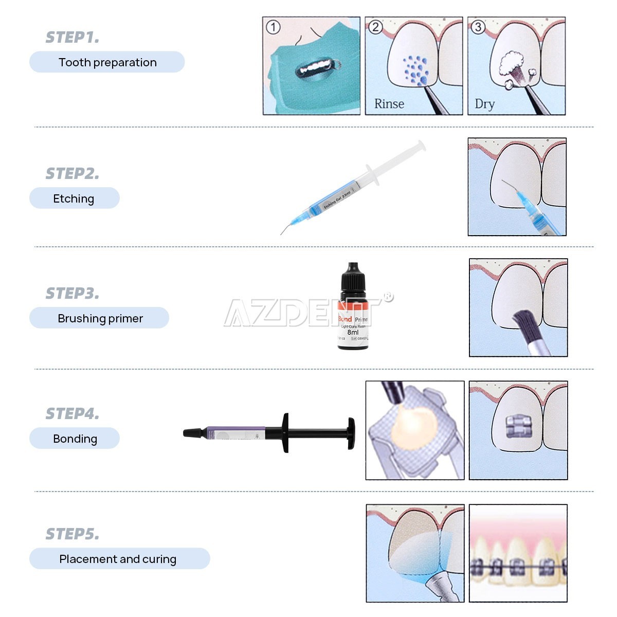 Dental Bracket Braces Glue Ortho Bonding Agents Light Cure Resin Adhesive Kit