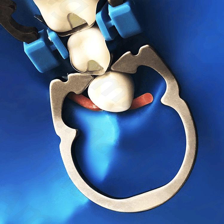 Dental Titanium Ring Stainless Matrices Clamp Separator Matrices Forcep Tweezer