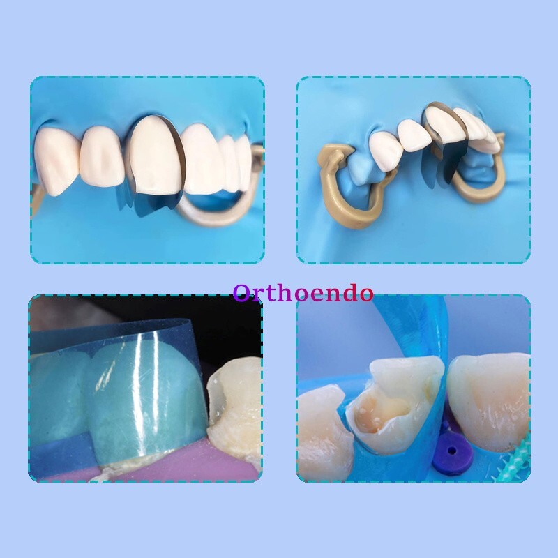 Dental Contoured Anterior Matrix Bands Resin Restoration Blue Strip Twin Matrice