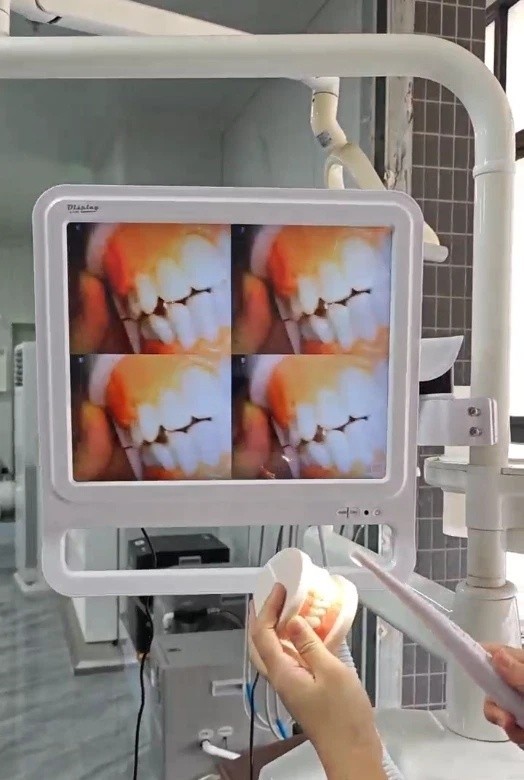 Dental Digital Intraoral Camera with Electric Monitor
