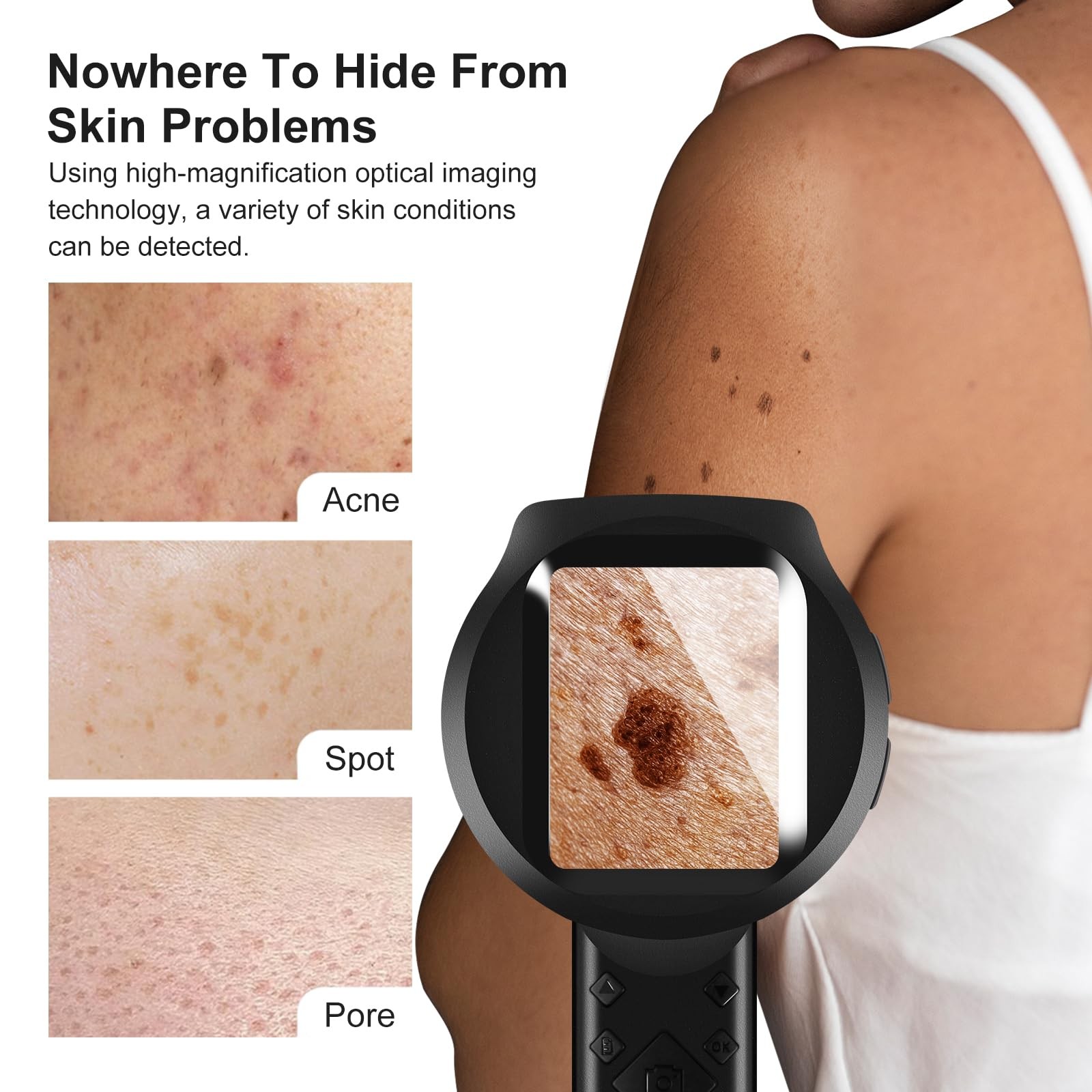 Handheld Dermatoscope, 500X Magnification Skin & Scalp Analyzer for Scalp/Hair