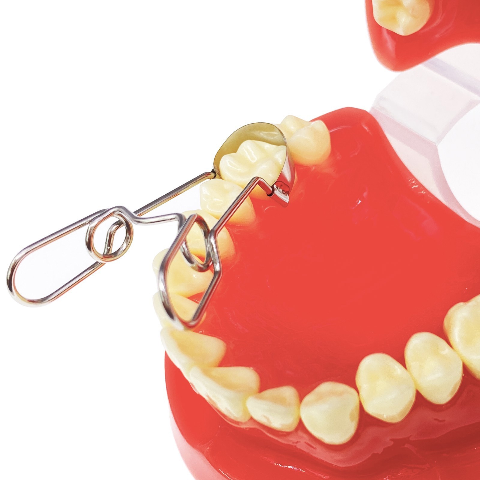 Dental Saddle Contoured Metal Matrices Matrix Band 6 Sizes / Springclip