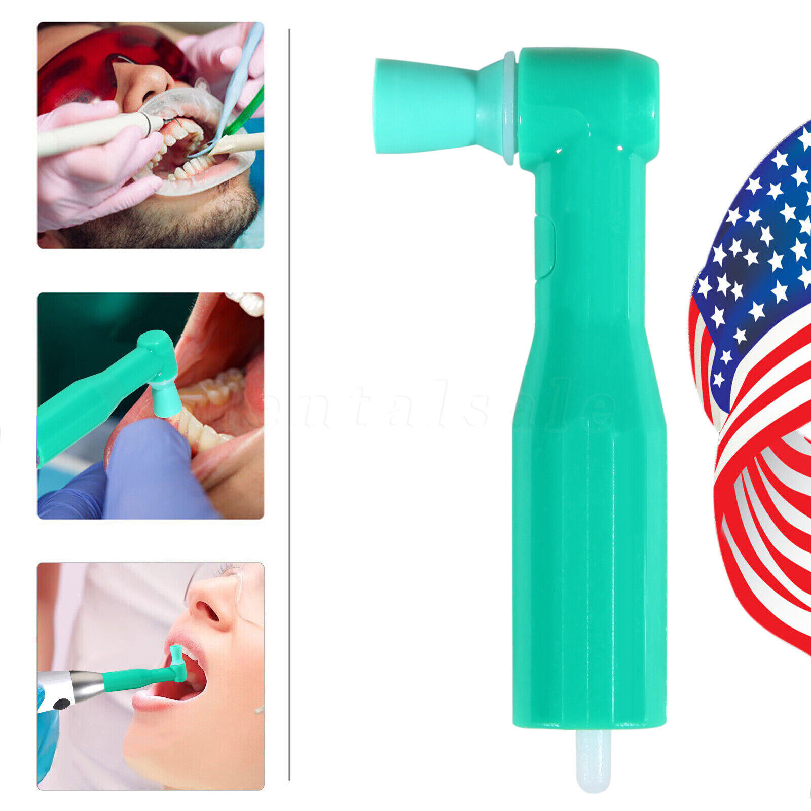 100pcs Dental Angel 90° Disposable Prophy Cup Angles Soft Latex Free Cups Green