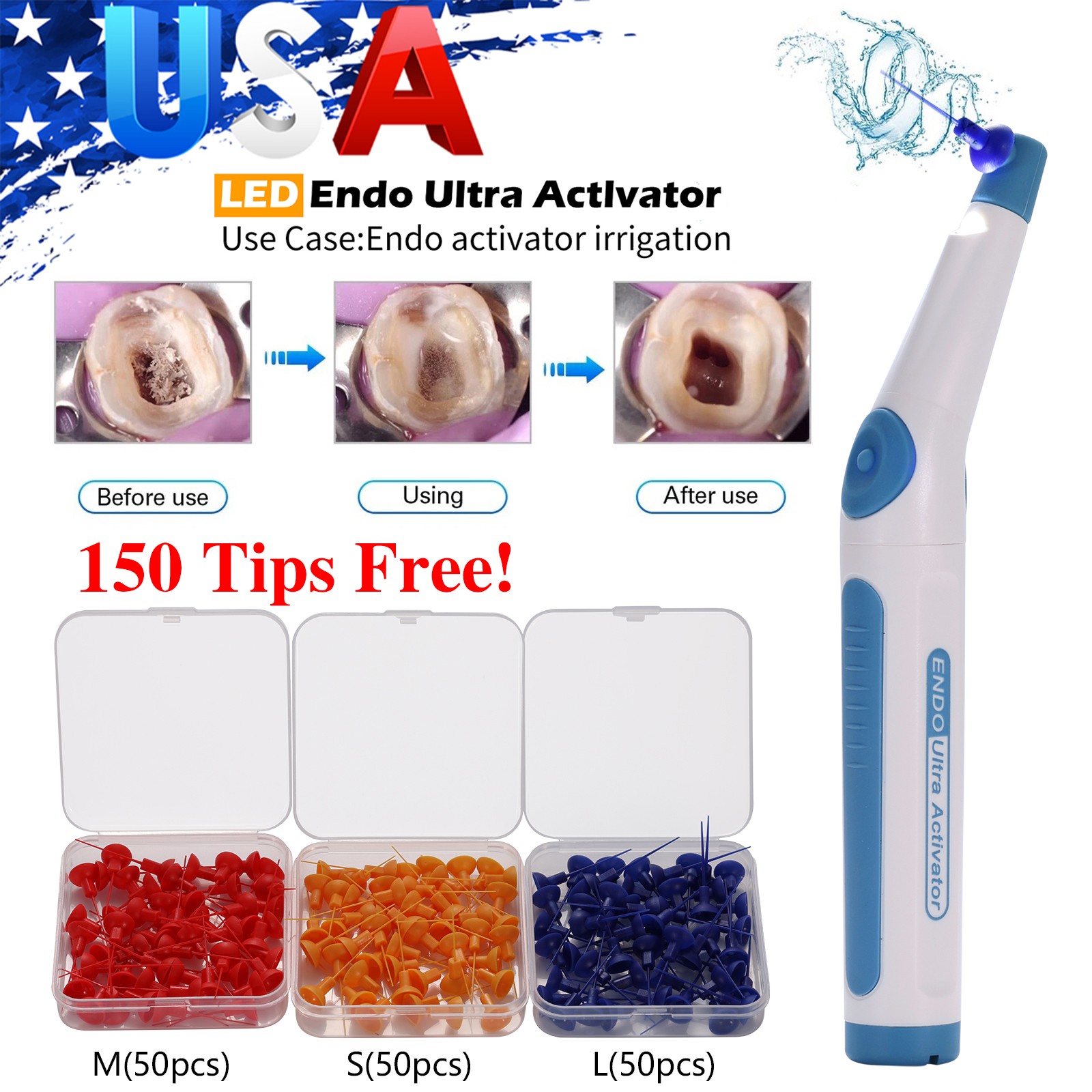 Dental Endodontic Endo Activator Sonic Endo Ultra Irrigator Root Canal +150 Tips
