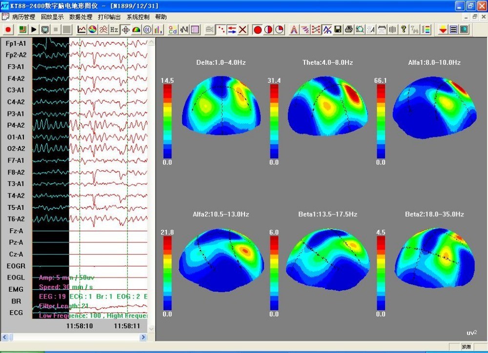 KT88-2400 24 Channel EEG Brain Electrical Activity Mapping System Software