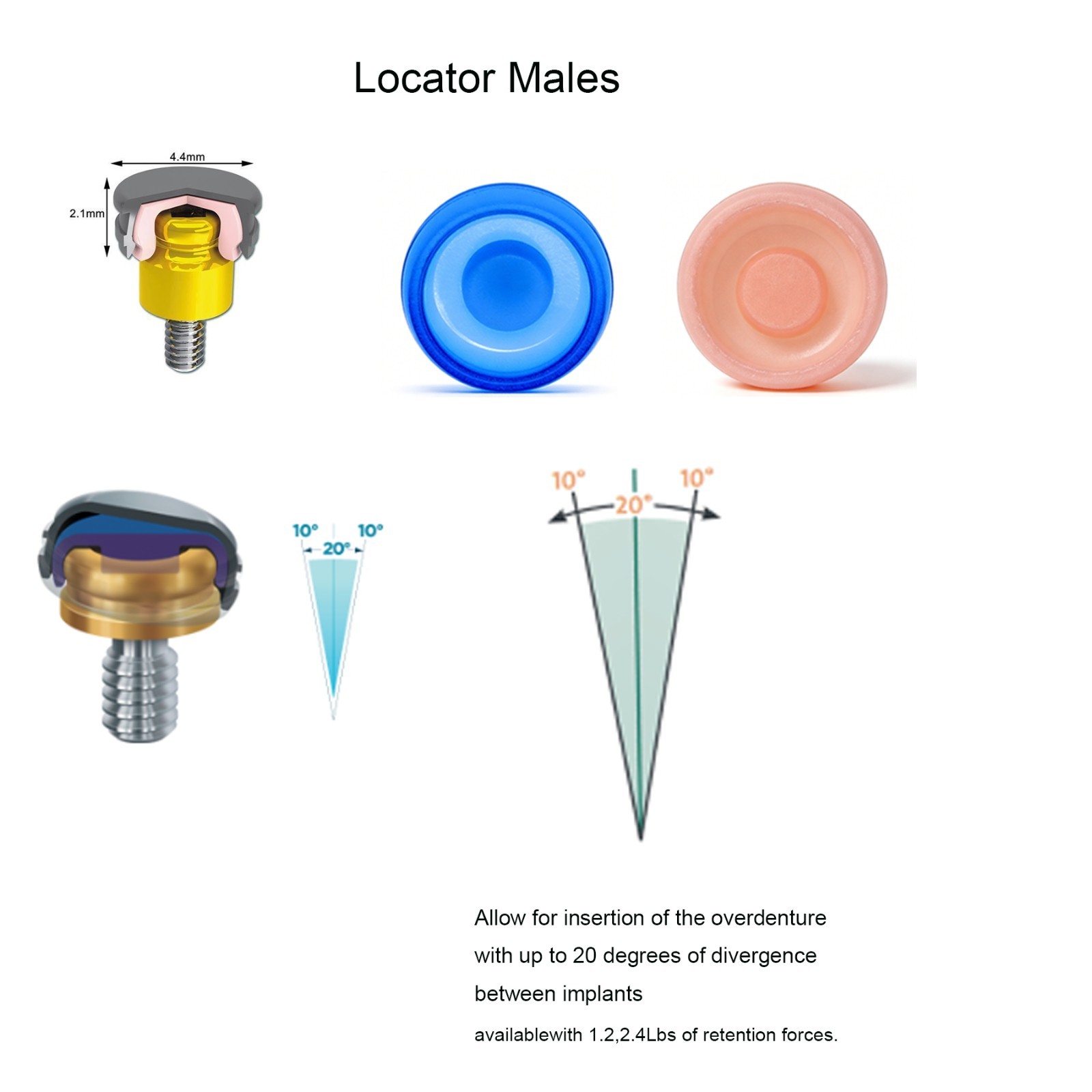 US Dental Attachment Locator Abutment for HIOSSEN ET ZEST Legacy anchor OSS