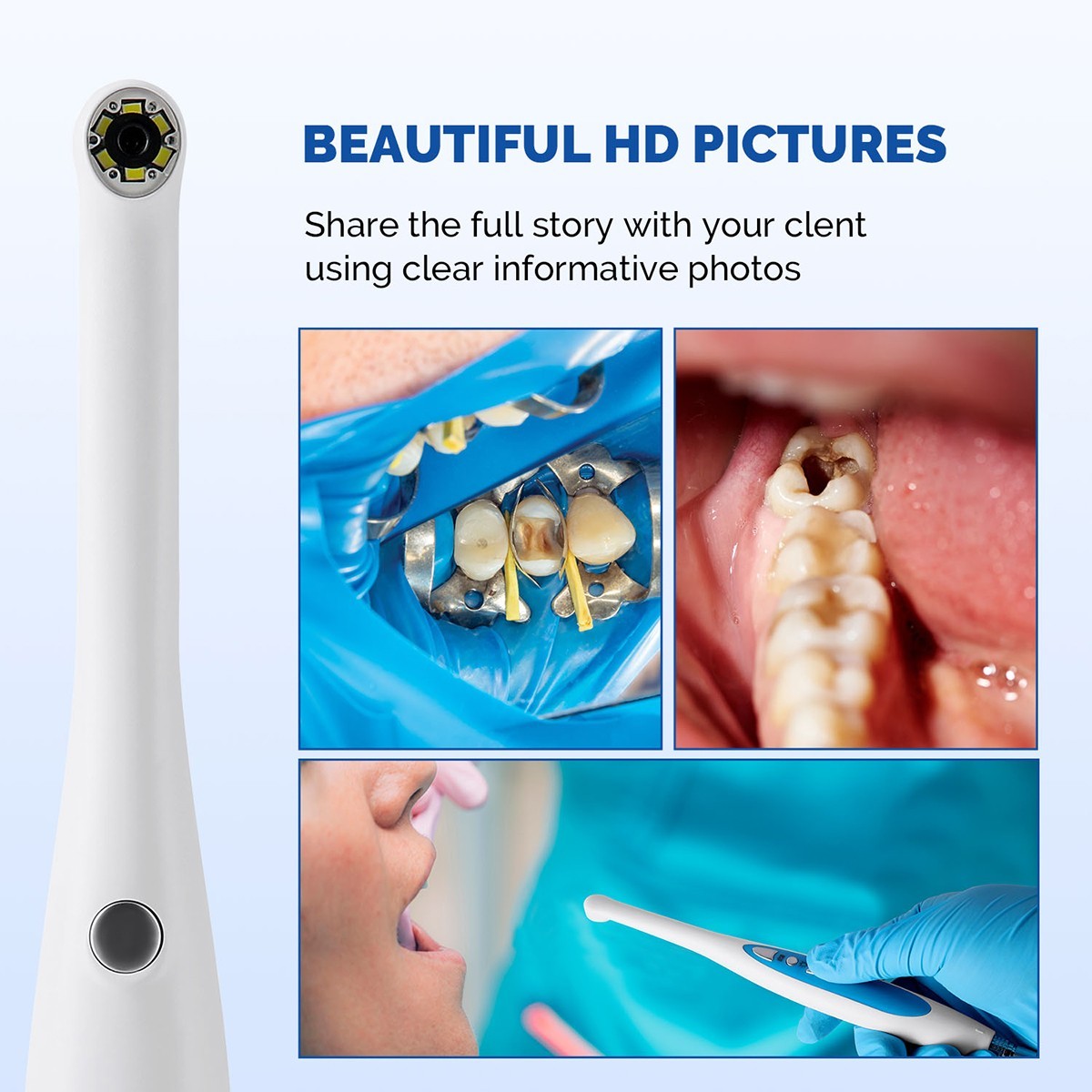 AZDENT Dental HD Intraoral Camera USB Digital Imaging Work on Dexis/Eaglesoft
