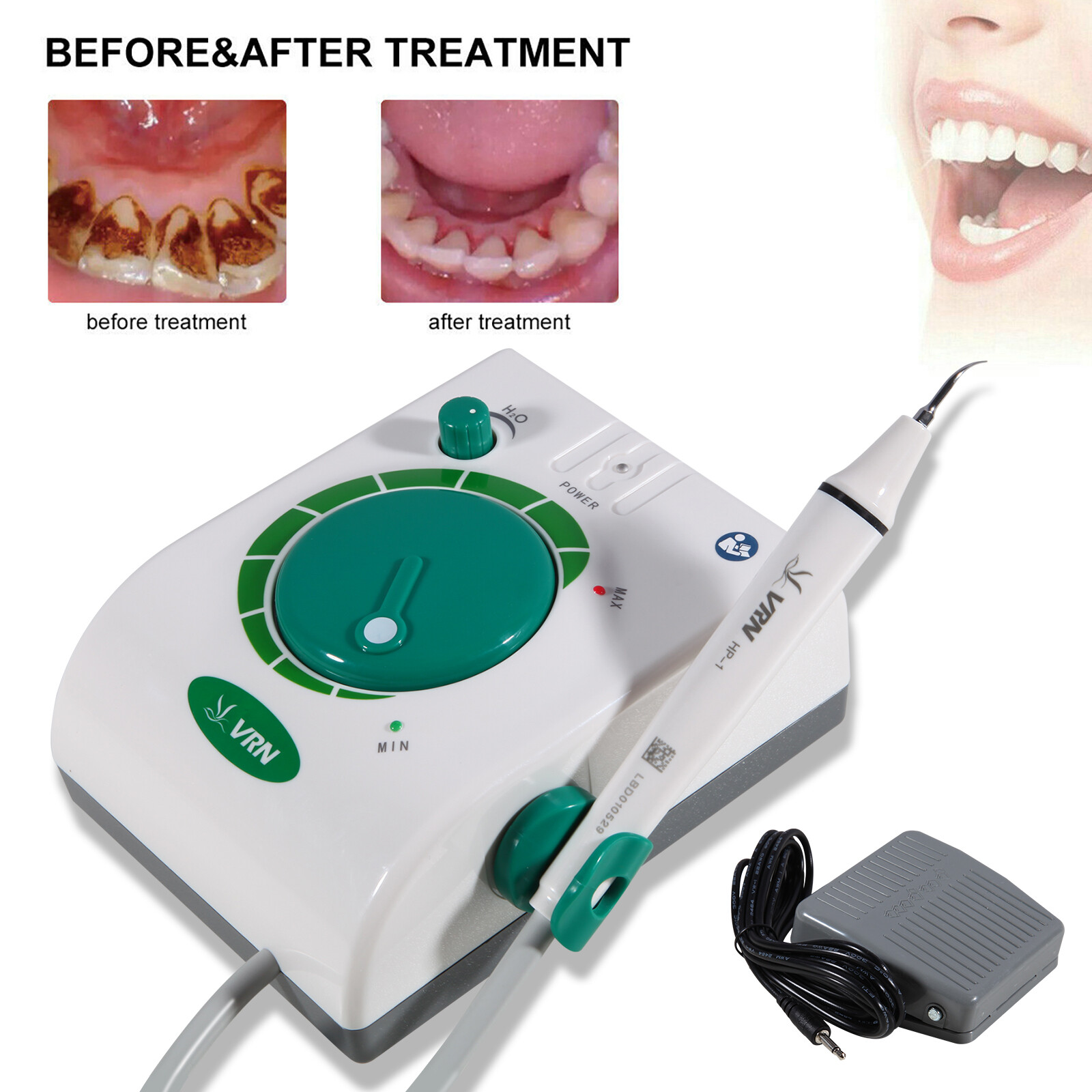 Dental Ultrasonic Scaler Teeth Cleaning Machine Calculus Remover with 5 Tips