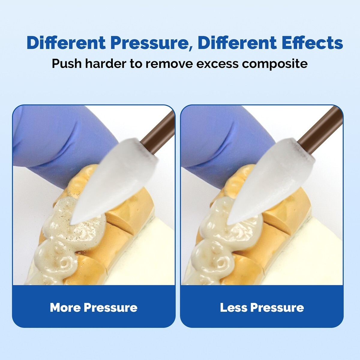 Dental Composite Polishing & Finishing Points/Cups/Discs RA Shank Fit ENHANCE