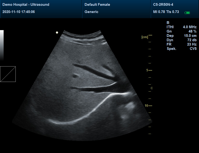 Ultrasonic Diagnostic System abdomen/convex probe CONTEC CMS600P2 PLUS+Free PW