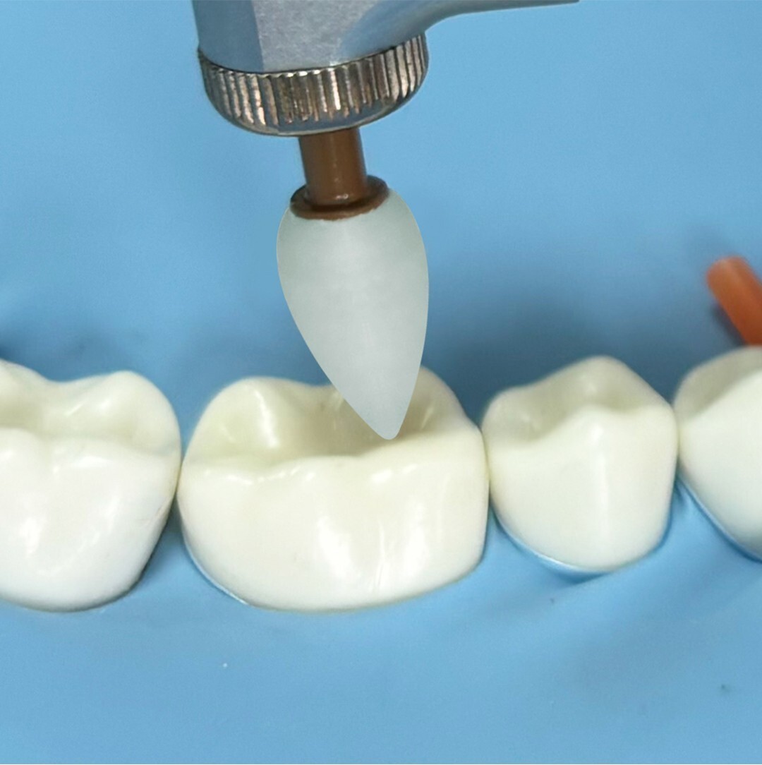 Dental Composite Polishing Finishing Finisher RA Points/Cups/Discs Fit ENHANCE